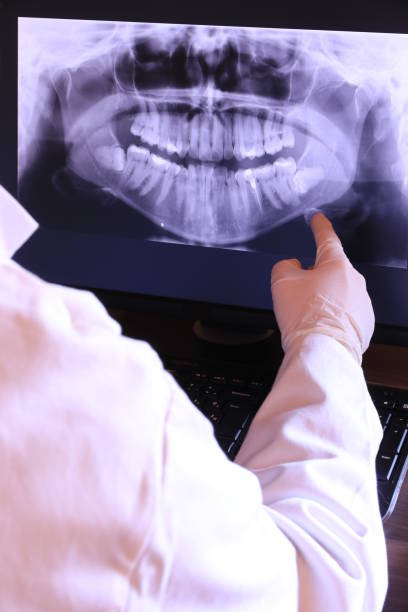 Best Emergency Root Canal Treatment in Maryville, MO
